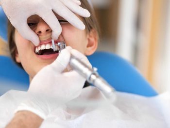 Você realmente sabe quando precisa realizar a limpeza dental?