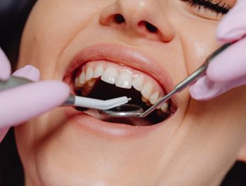 Com que frequência realizar a limpeza dental em consultório?