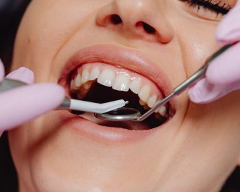 Com que frequência realizar a limpeza dental em consultório?