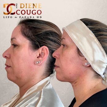dra-diene-cougo-resultado-01.jpg