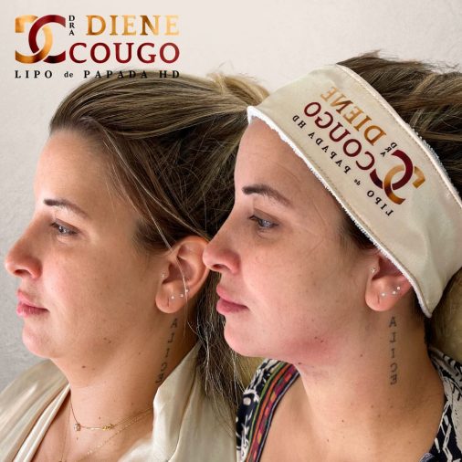 dra-diene-cougo-resultado-02.jpg