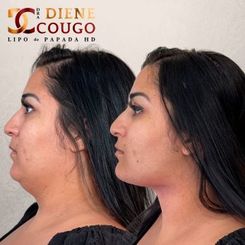 dra-diene-cougo-resultado-03.jpg
