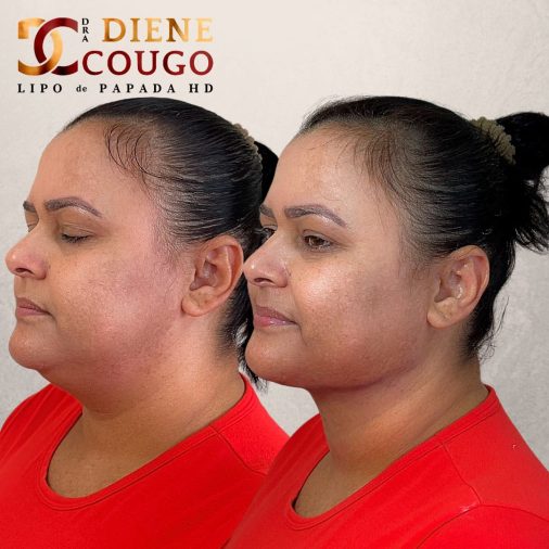 dra-diene-cougo-resultado-05.jpg